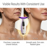 7-in-1 LED Neck & Jawline Sculpto